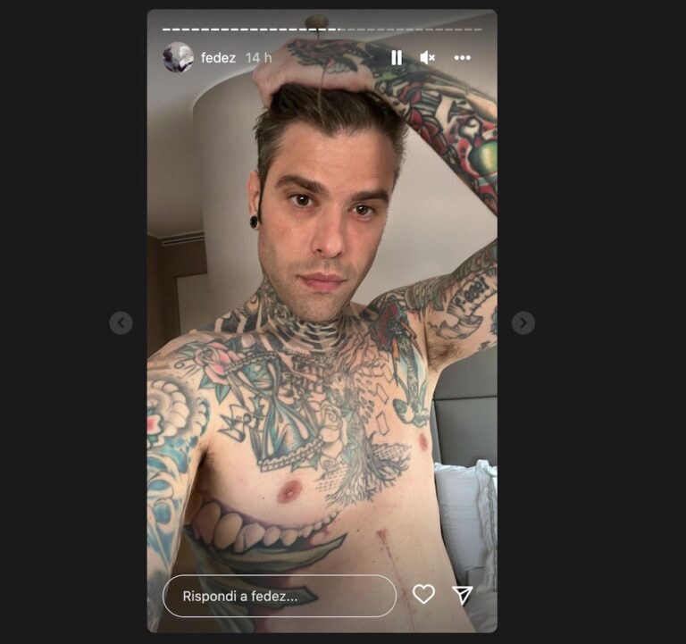 Fedez, Attività Fisica Due Mesi Dopo L'intervento Per Il Cancro | MondoVip